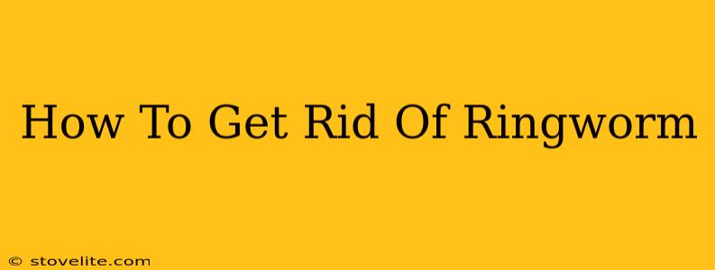 How To Get Rid Of Ringworm