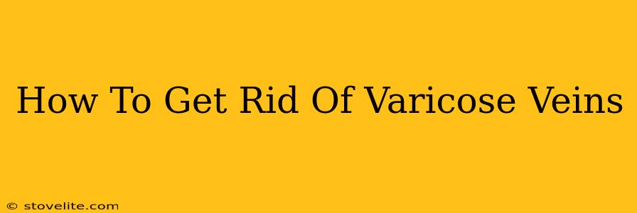 How To Get Rid Of Varicose Veins