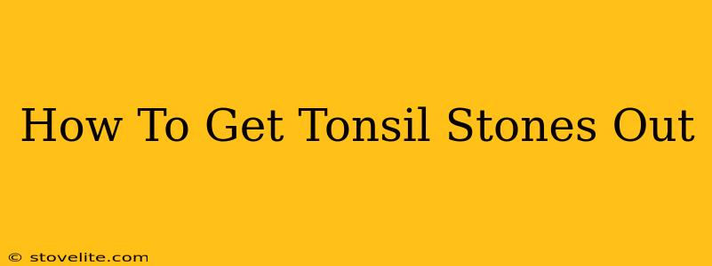 How To Get Tonsil Stones Out