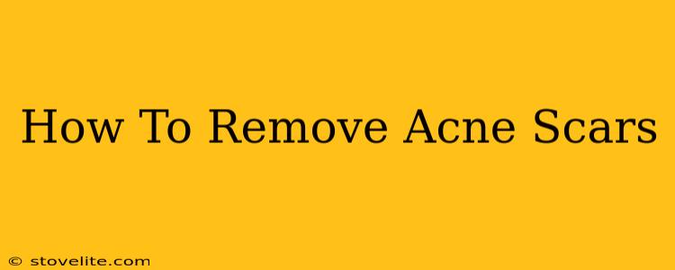 How To Remove Acne Scars