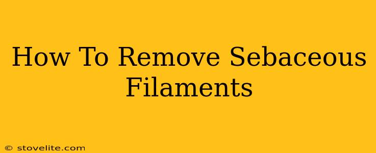 How To Remove Sebaceous Filaments