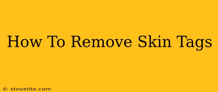 How To Remove Skin Tags