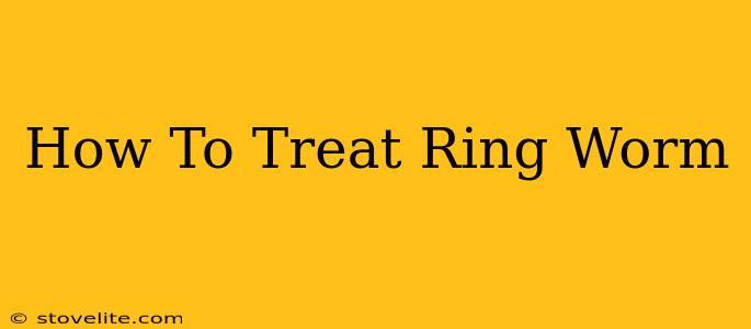 How To Treat Ring Worm