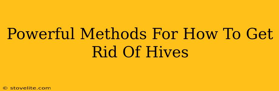 Powerful Methods For How To Get Rid Of Hives